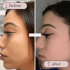 Simply’s LumiSculpt Pro 7-in-1